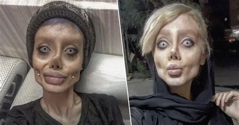 Angelina Jolie Before Plastic Surgery Pictures