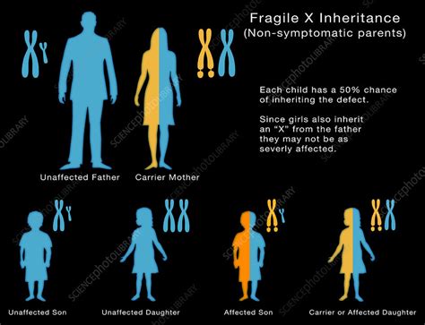 Fragile X Inheritance Illustration Stock Image C0306640 Science
