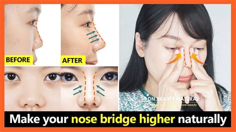 How To Make My Nose Bridge Higher Without Surgery Or Makeup Saubhaya