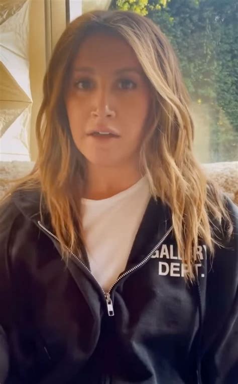 Ashley Tisdale Shares Years Long Struggle With Hair Loss After Alopecia Diagnosis