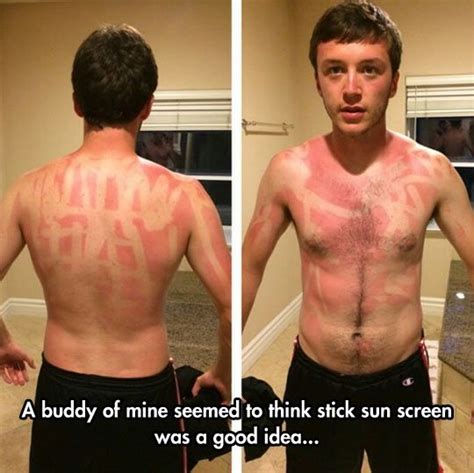 Xd Cant Stop Laughing Laughing So Hard Sunburn Art Funny Fails