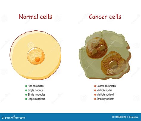 癌症和正常细胞 比较与差异 向量例证 插画 包括有 入侵 女主持人 正常 科学 绘制 详细资料 215683228