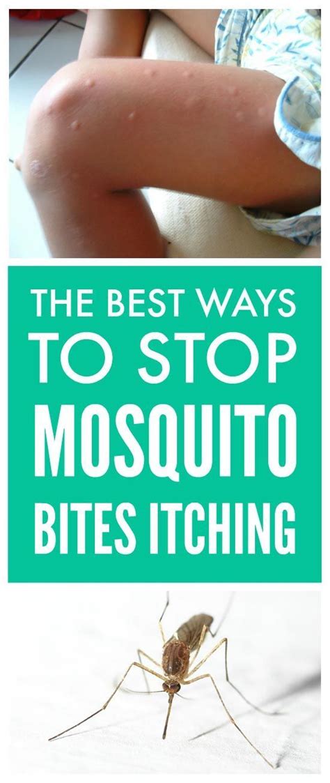Stop Mosquito Bites Itching Remedies For Mosquito Bites Mosquito
