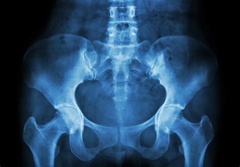 Understanding The Signs And Symptoms Of Pelvic Prolapse Complete