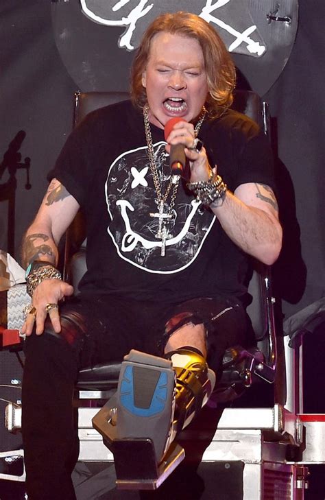 Guns N Roses At Coachella Axl Rose Performs With Broken Foot