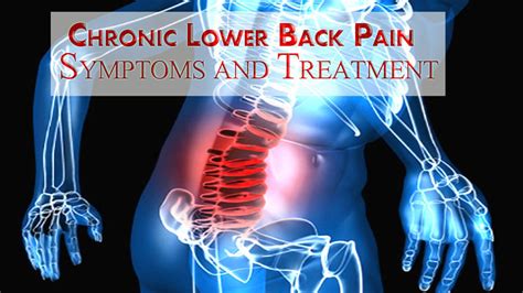 Lower back pain is one of the commonest problems in the united states. Chronic Lower Back Pain - Chronic Lower Back Pain Symptoms ...