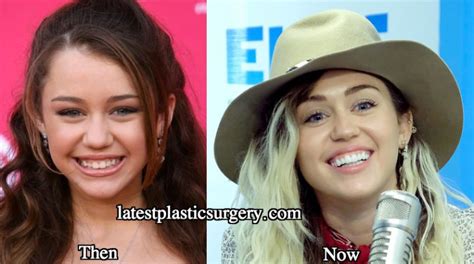 Miley Cyrus Teeth Did Miley Cyrus Fix Her Teeth