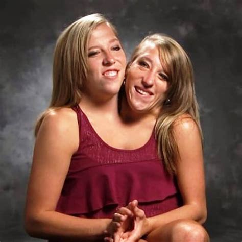 Conjoined Twins Abby And Brittany Hensel Married Conjoined Twins