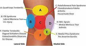 Knee Our Knee Diagnosis Chart Helps You To Work Out What Is