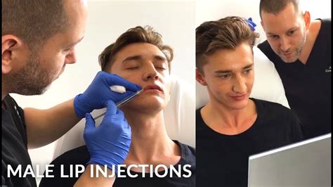 Young Man Getting Lip Enhancement Treatment Male Lip Injections With