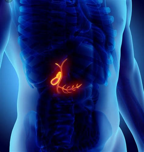 Gallbladder Polyps Symptoms Causes And Treatment Santripty