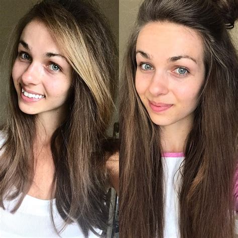 Both Pictures I Am Wearing No Makeup And On The Right Is Before I