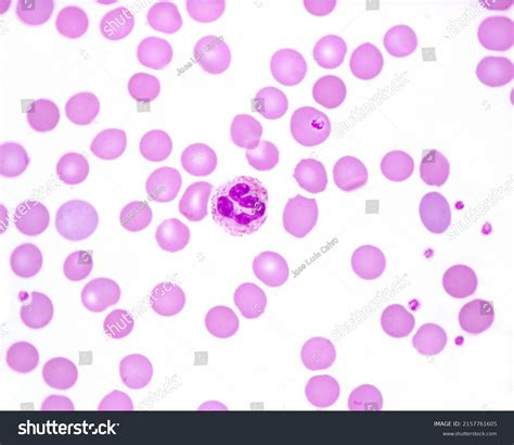 Human Blood Smear Where Neutrophil Leukocyte Foto Stok 2157761605