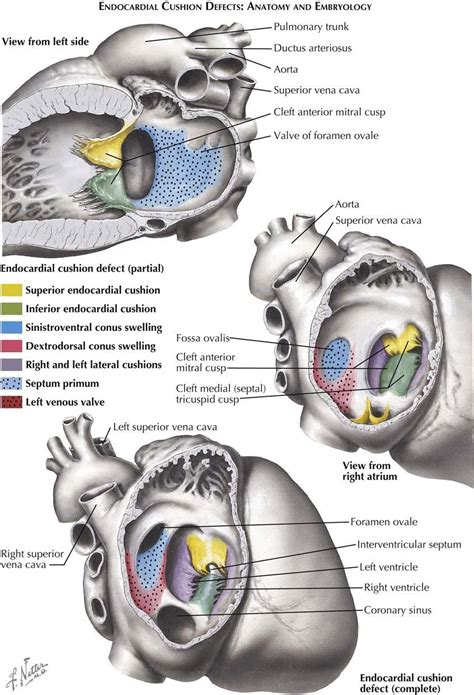 5 Congenital Heart Disease Congenital Heart Congenital Heart