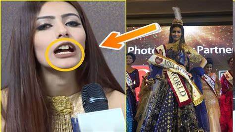 এবার দাঁত নিয়ে বিতর্কে জড়ালেন জেসিয়া। Jessia Islam Miss World Bangladesh 2017 Youtube