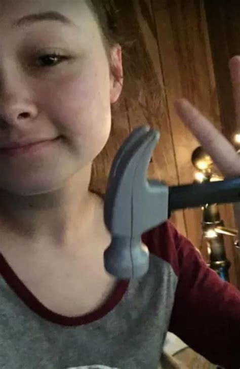 Hammer Stuck In Teens Mouth After Dare