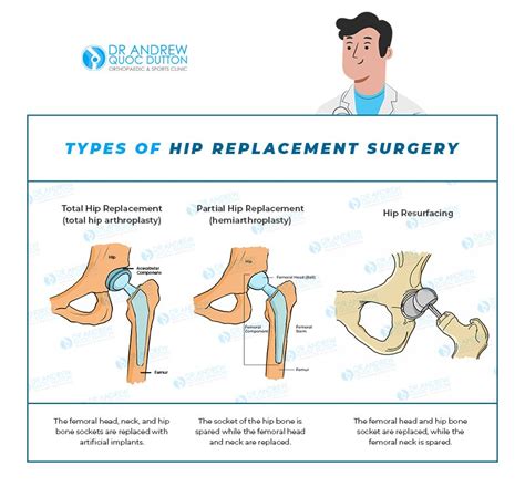 Signs That A Hip Replacement Surgery Might Be Needed