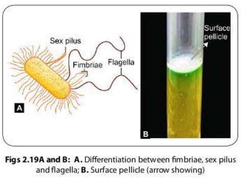 Bacterial Fimbriae Or Pili Organ Of Adhesion And Gene Transfer