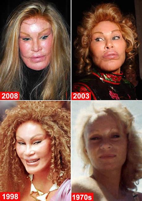 Worst Plastic Surgery Disasters Page Daily Fun Lists