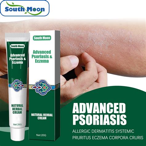 Ringworm Treatment Ringworm Cream Relieves Itching Cream