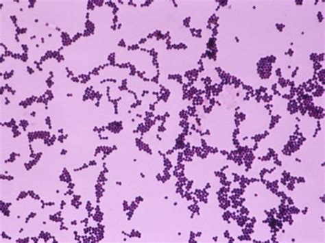 Staphylococcus Aureus Gram Positive Cocci Bacteria Lm X400