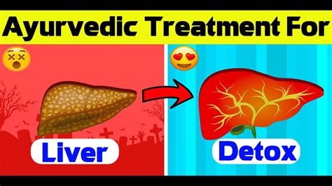 Ayurvedic Treatment For Liver Detoxification Herbs For Liver