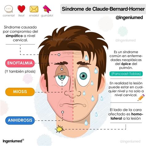 Sx De Claude Bernard H Rner Cosas De Enfermeria Enfermedades Del Ojo