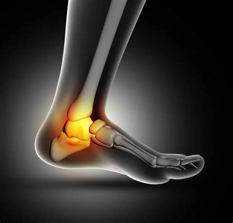 Ankle Joint Stiffness Cause Physiotherapy Treatment Exercise