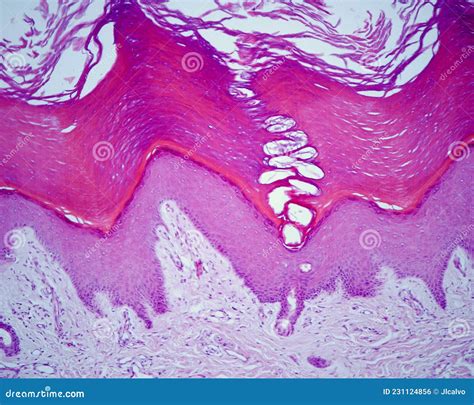 Thick Skin Epidermis Layers Stock Photo Image Of Skin Microscope