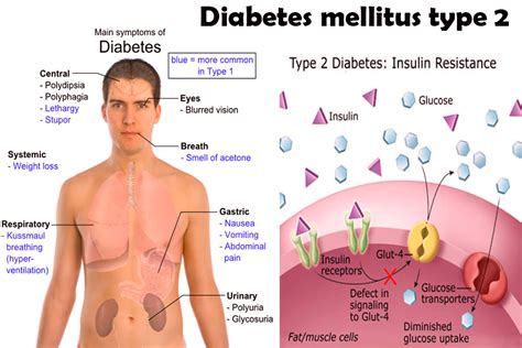 If the initial screening is performed before 24 weeks of. Diagnosis Diabetes Type 2 Criteria | Salemfreemedclinic ...
