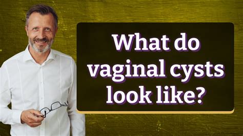 What Do Vaginal Cysts Look Like Youtube