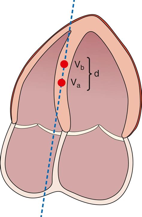 Tissue Doppler Myocardial Work Physics And Techniques Clinical Tree