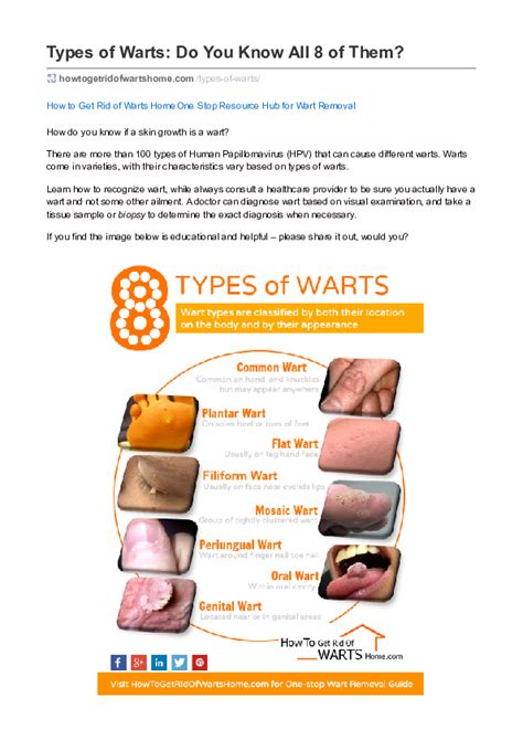 How To Identify Different Types Of Warts 861