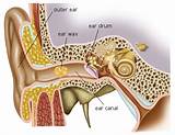 Ear Irrigation Pump Images