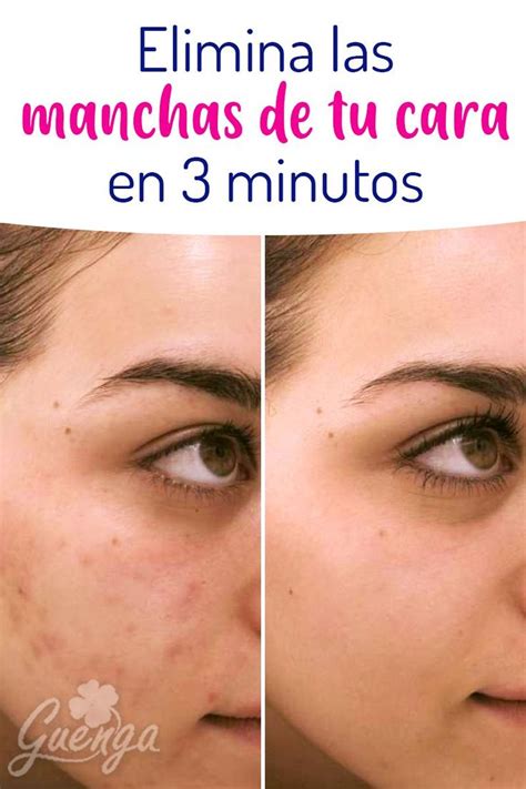 Elimina Las Manchas De Tu Cara En 3 Minutos Beauty Skin Care Routine