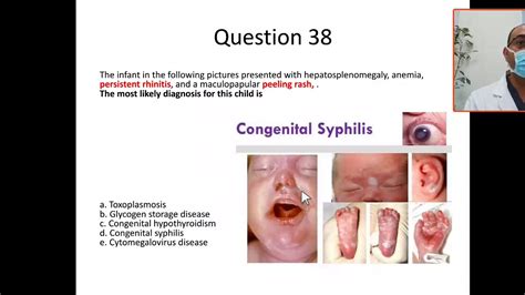 Congenital Syphilis