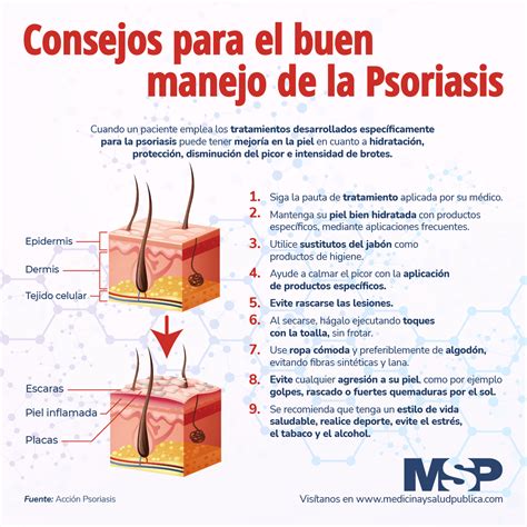 Consejos Para El Buen Manejo De La Psoriasis Infografía
