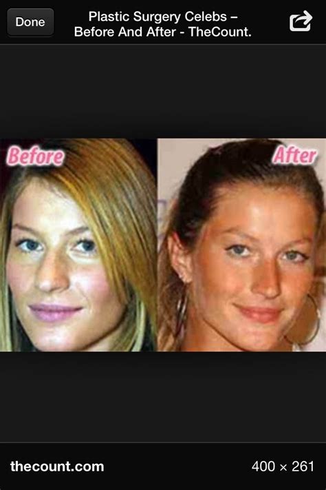 Gisele Plastic Surgery Nose Job Celebrity Plastic Surgery