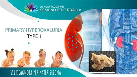 07 Primary Hyperoxaluria Type 1 Youtube
