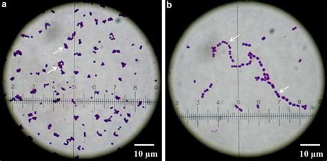 Bacterial Morphology A Gram Positive Coccus Shaped Organisms