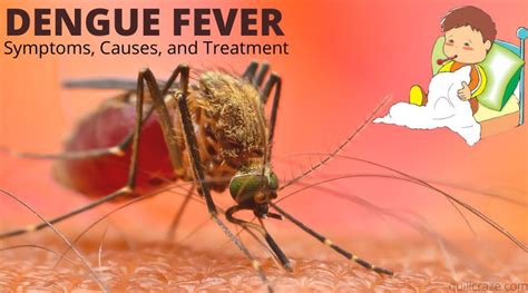 Dengue Fever Symptoms Causes And Treatment