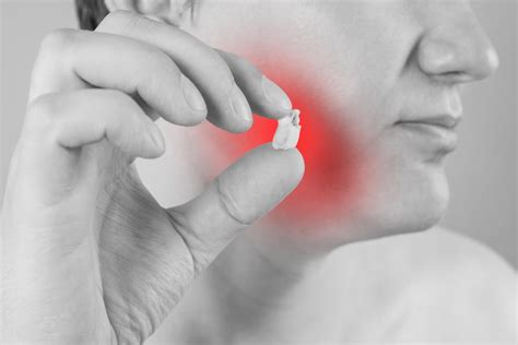 Dont Fear Wisdom Tooth Extraction Santa Rosa Oral Surgery