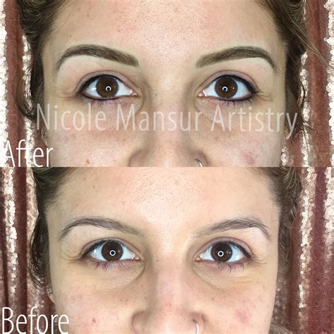 Permanent Eyeliner Before And After Photos Orange County Ca