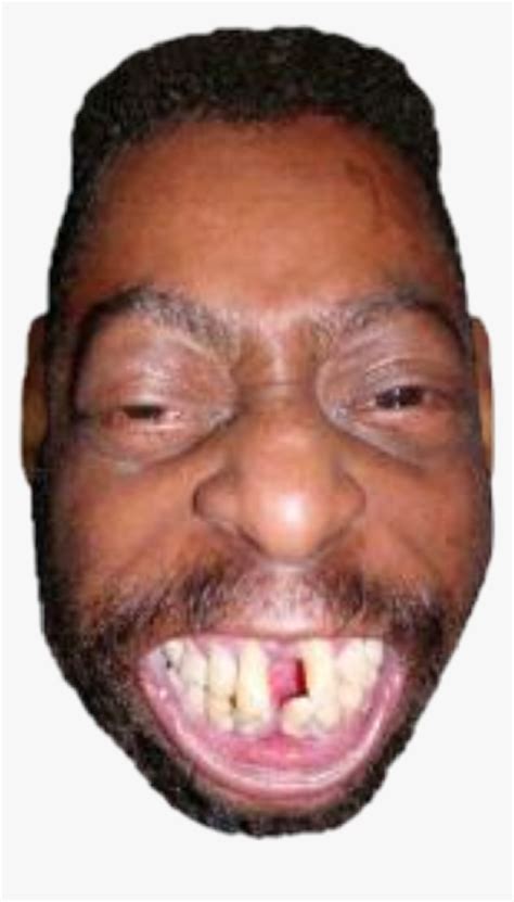 Black People With Messed Up Teeth Hd Png Download Kindpng