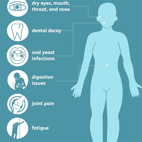 Sjogrens Syndrome Symptoms Causes Diagnosis And Treatment