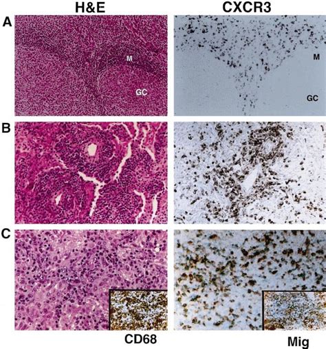 Expression Of The Chemokine Receptor Cxcr3 A Normal Tonsil Shows