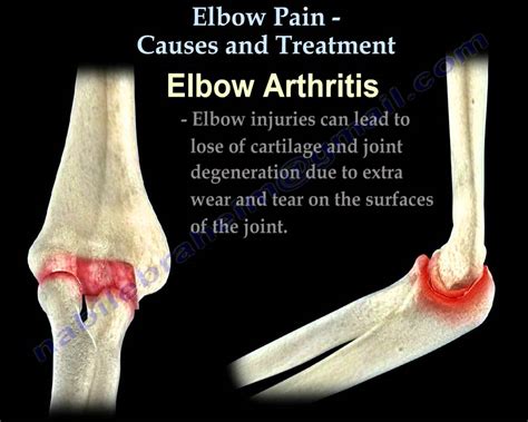 Anatomy Of The Elbow Joint