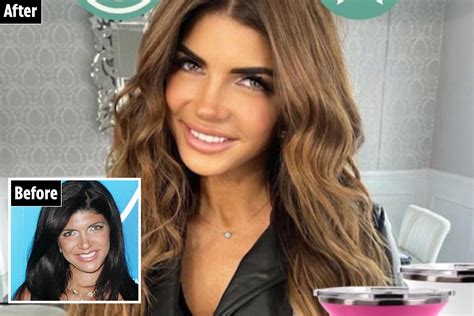 Rhonjs Teresa Giudice Is Totally Unrecognizable After Nose Job And Lip Fillers In New Photo