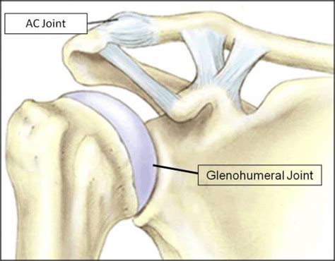 Acromioclavicular Joint Separation Ac Separation Orland Park