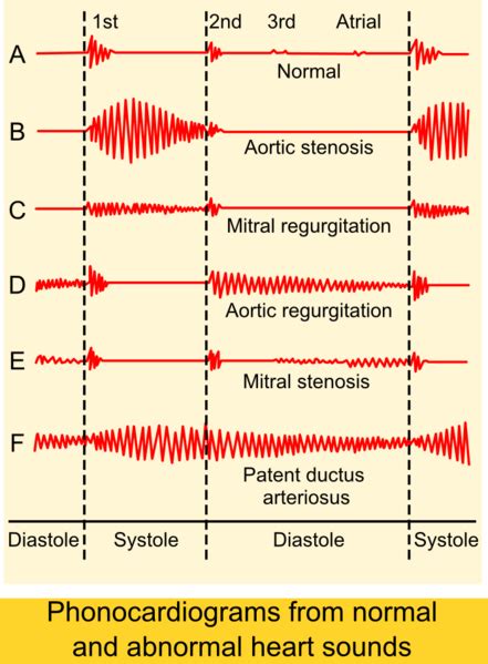 There are many parts and functions of the heart, with one of them being the apex. Systolic heart murmur - wikidoc